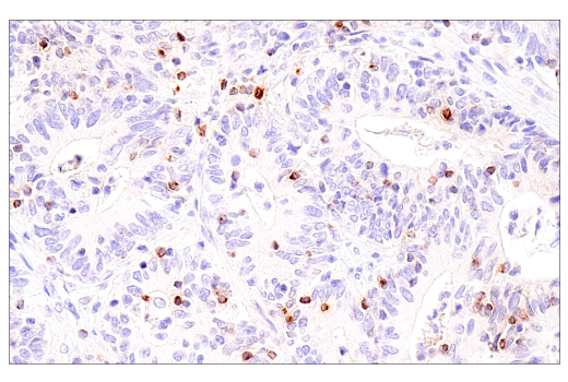Immunohistochemistry Image 1: CCL5/RANTES (E9S2K) Rabbit mAb (BSA and Azide Free)