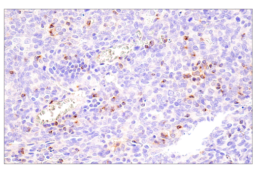 Immunohistochemistry Image 5: CCL5/RANTES (E9S2K) Rabbit mAb (BSA and Azide Free)