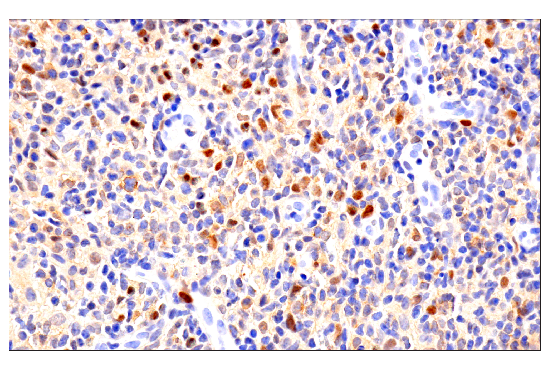 Immunohistochemistry Image 3: Notch2 (D76A6) XP® Rabbit mAb