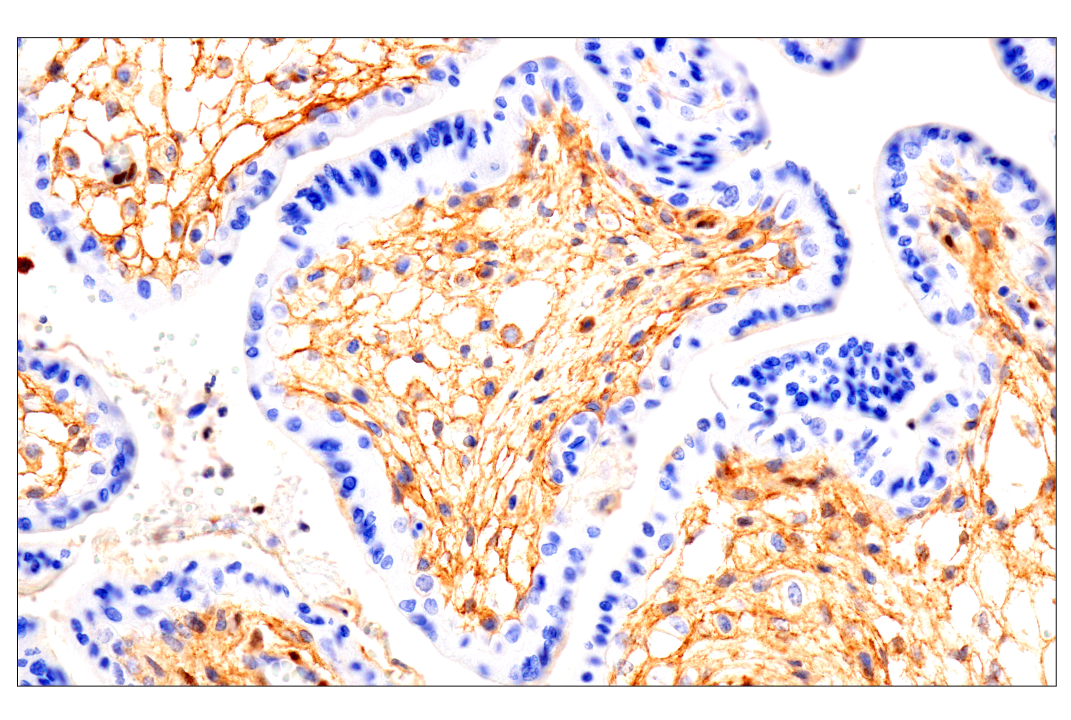 Immunohistochemistry Image 4: Notch2 (D76A6) XP® Rabbit mAb