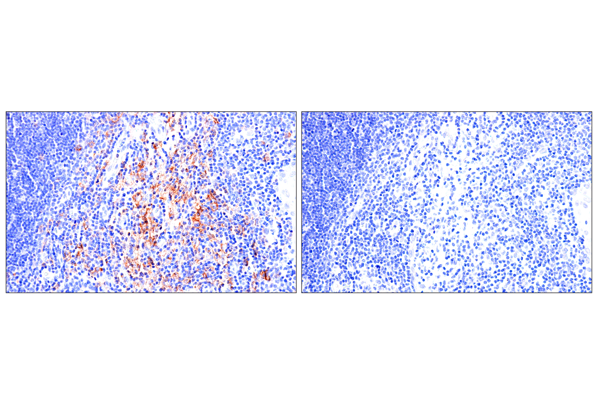 Immunohistochemistry Image 9: Semaphorin-4A (E5N3K) Rabbit mAb