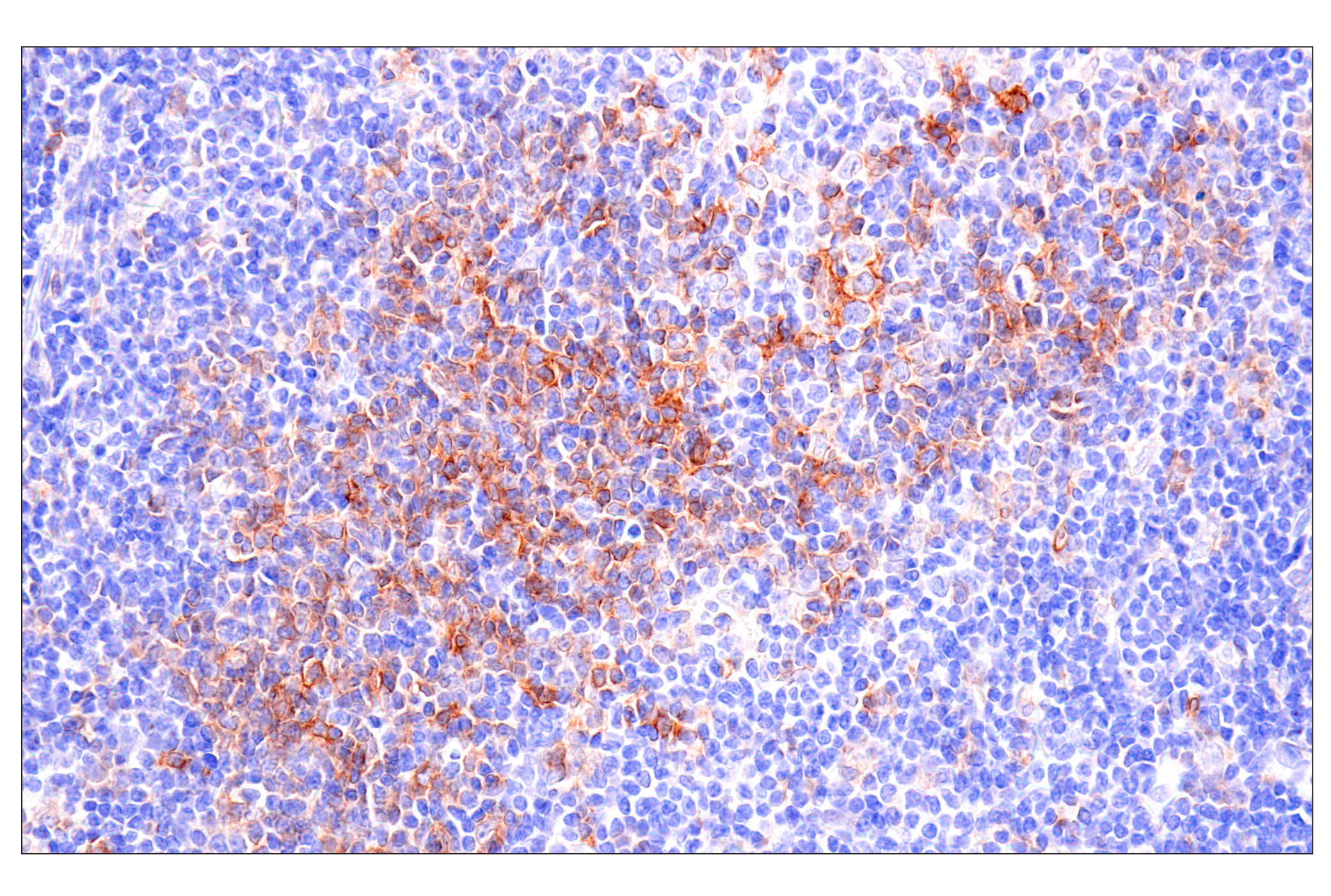 Immunohistochemistry Image 1: Semaphorin-4A (E5N3K) Rabbit mAb
