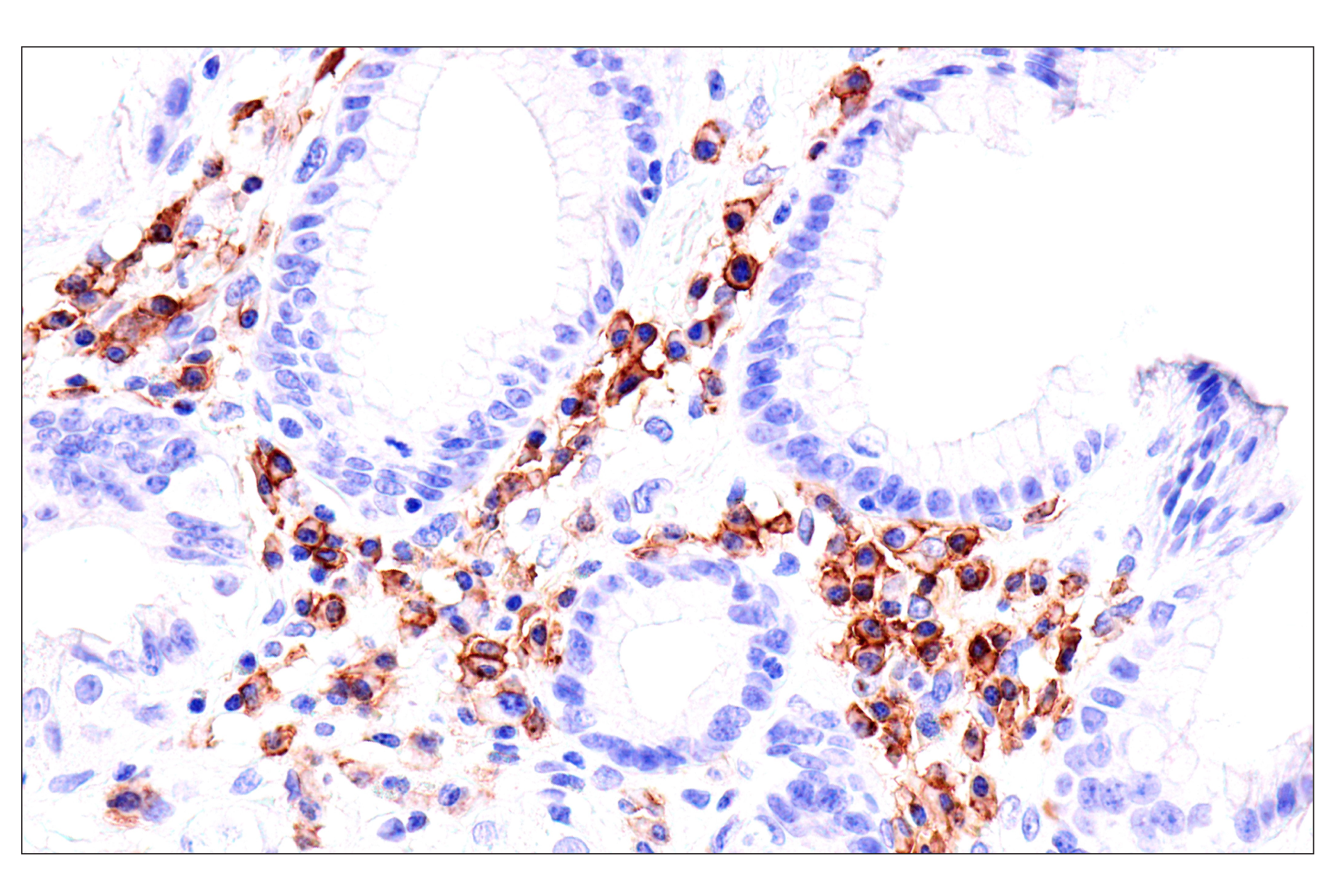 Immunohistochemistry Image 8: Semaphorin-4A (E5N3K) Rabbit mAb