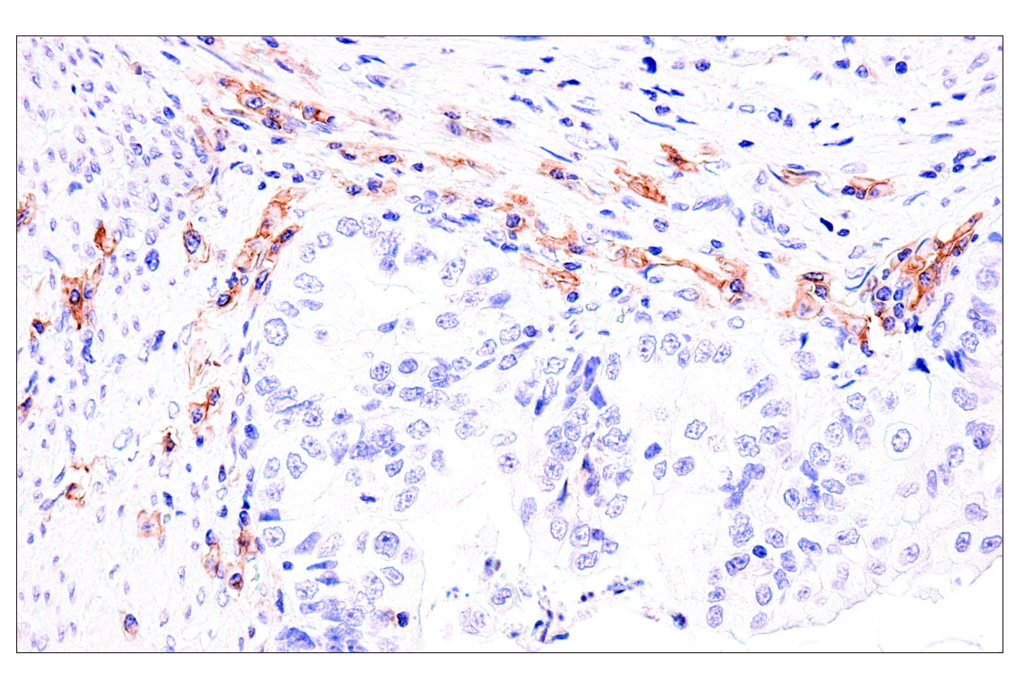 Immunohistochemistry Image 3: Semaphorin-4A (E5N3K) Rabbit mAb
