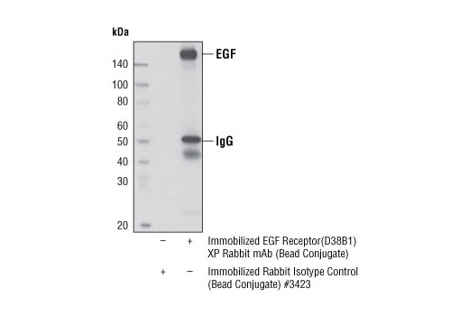 Immunoprecipitation Image 1: EGF Receptor (D38B1) XP® Rabbit mAb (Sepharose® Bead Conjugate)