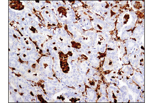 Immunohistochemistry Image 1: Gelsolin (D9W8Y) Rabbit mAb (BSA and Azide Free)