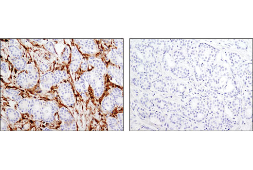 Immunohistochemistry Image 2: Gelsolin (D9W8Y) Rabbit mAb (BSA and Azide Free)
