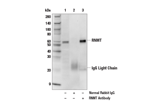 Immunoprecipitation Image 1: RNMT Antibody