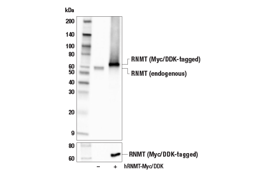 Western Blotting Image 1: RNMT Antibody