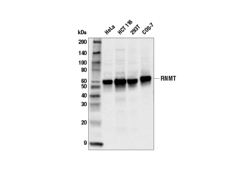 Western Blotting Image 2: RNMT Antibody