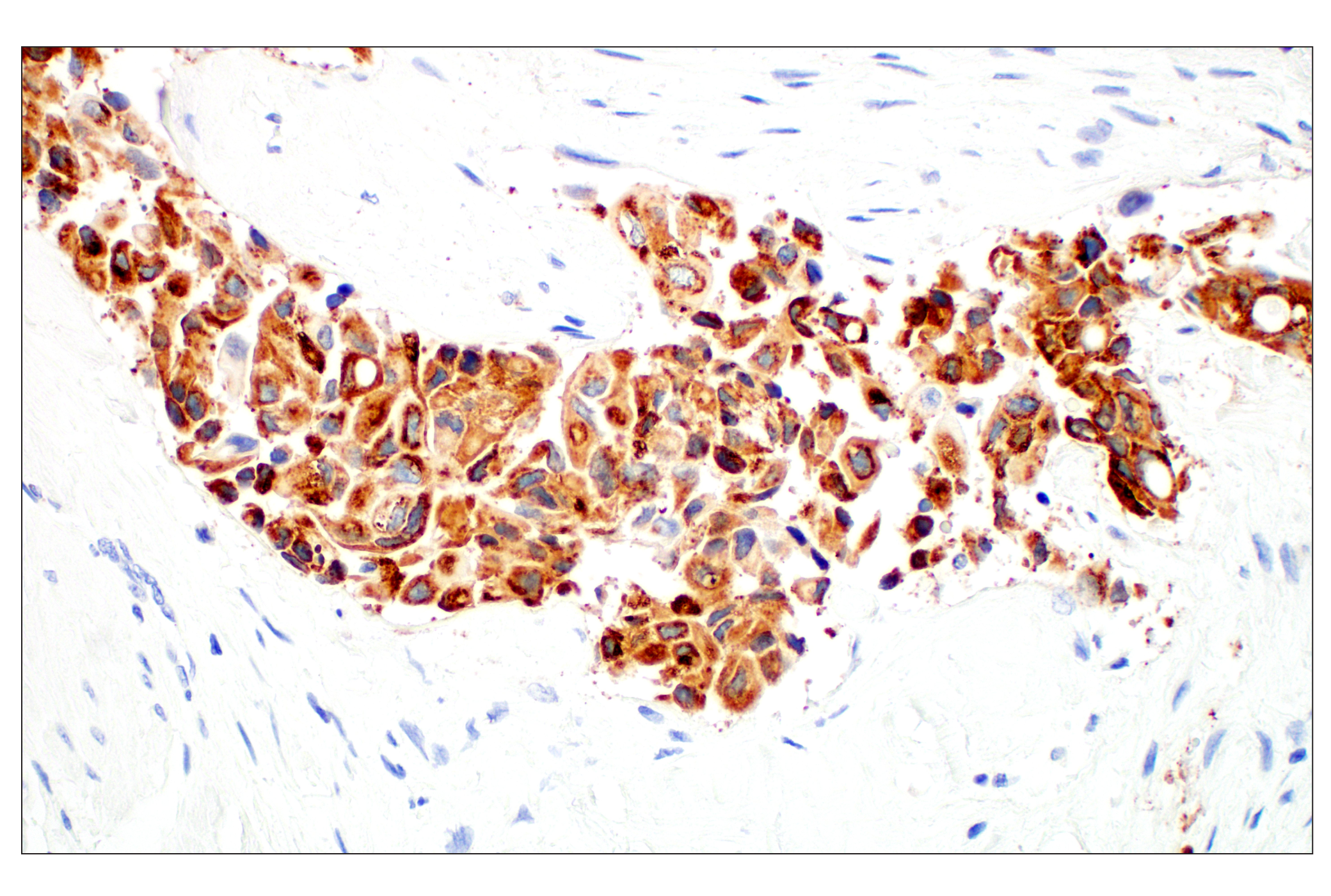 Immunohistochemistry Image 3: LPCAT1 (E4V4B) Rabbit mAb