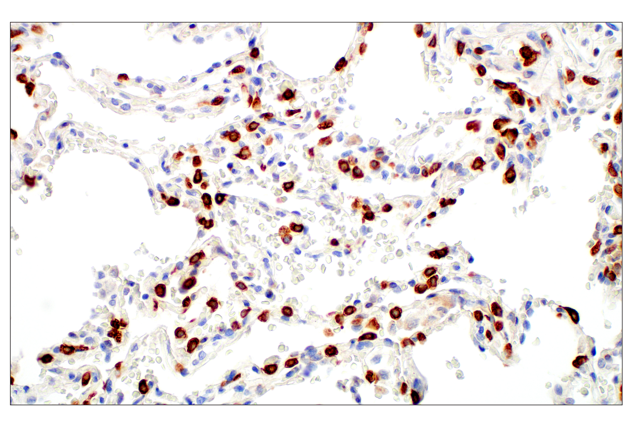 Immunohistochemistry Image 5: LPCAT1 (E4V4B) Rabbit mAb