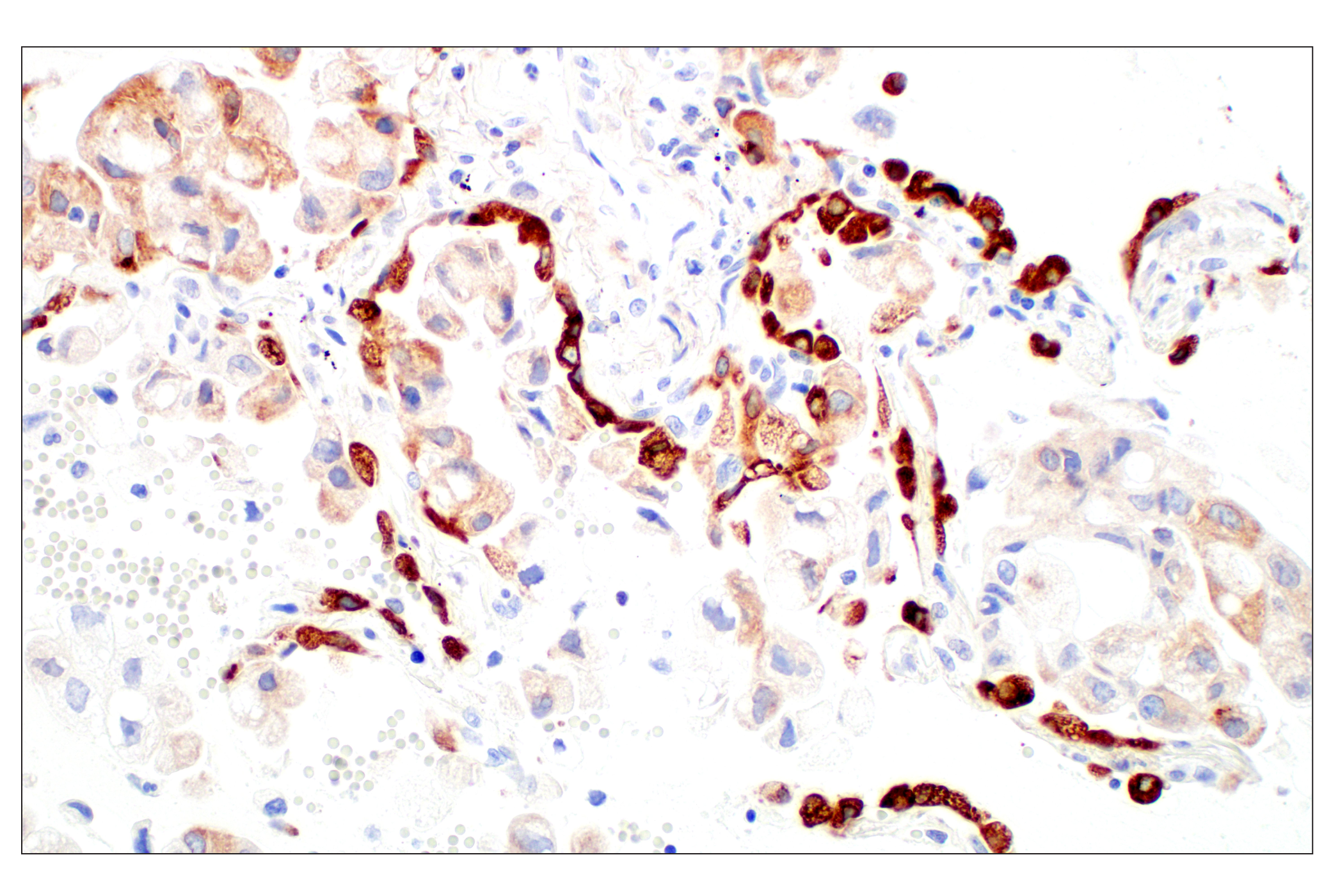 Immunohistochemistry Image 1: LPCAT1 (E4V4B) Rabbit mAb