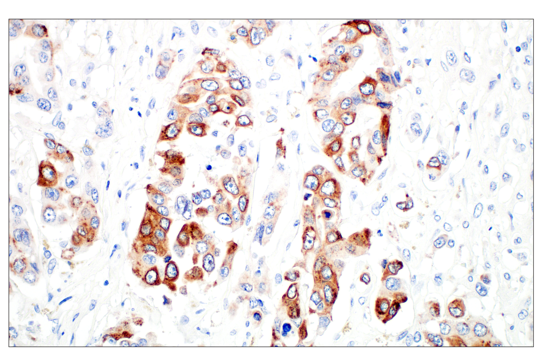 Immunohistochemistry Image 2: LPCAT1 (E4V4B) Rabbit mAb