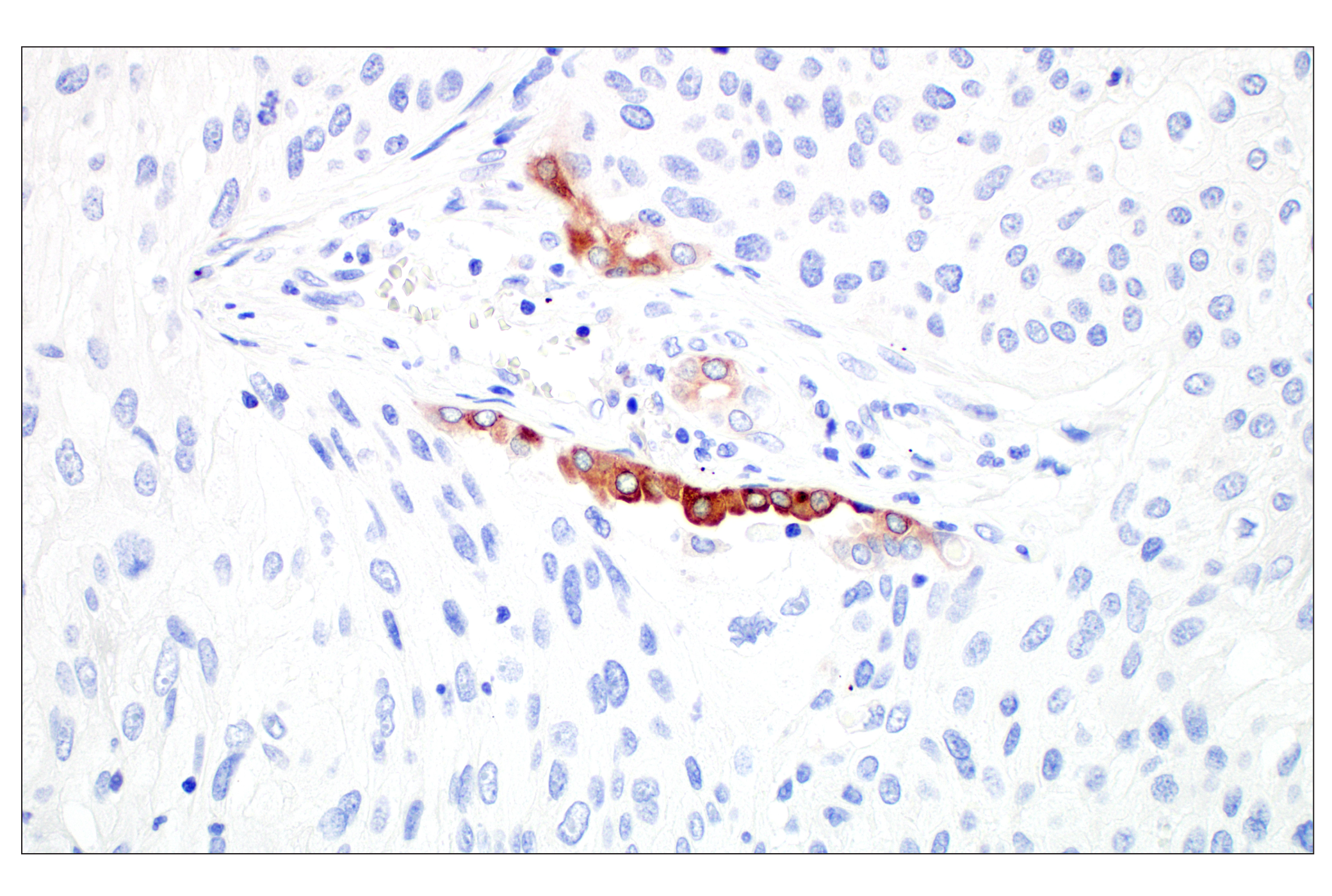 Immunohistochemistry Image 4: LPCAT1 (E4V4B) Rabbit mAb