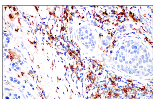 Immunohistochemistry Image 2: FcγRIIB (E4D2F) XP® Rabbit mAb (BSA and Azide Free)