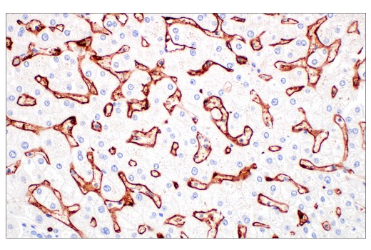 Immunohistochemistry Image 5: FcγRIIB (E4D2F) XP® Rabbit mAb (BSA and Azide Free)
