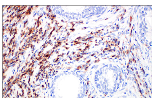Immunohistochemistry Image 6: FcγRIIB (E4D2F) XP® Rabbit mAb (BSA and Azide Free)