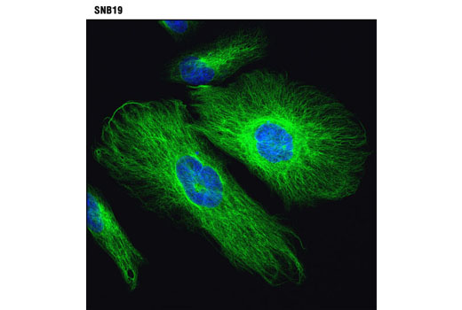  Image 20: Cell Fractionation Antibody Sampler Kit