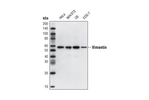 Western Blotting Image 1: Vimentin (D21H3) XP® Rabbit mAb