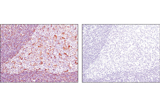  Image 37: Cancer Associated Fibroblast Marker Antibody Sampler Kit