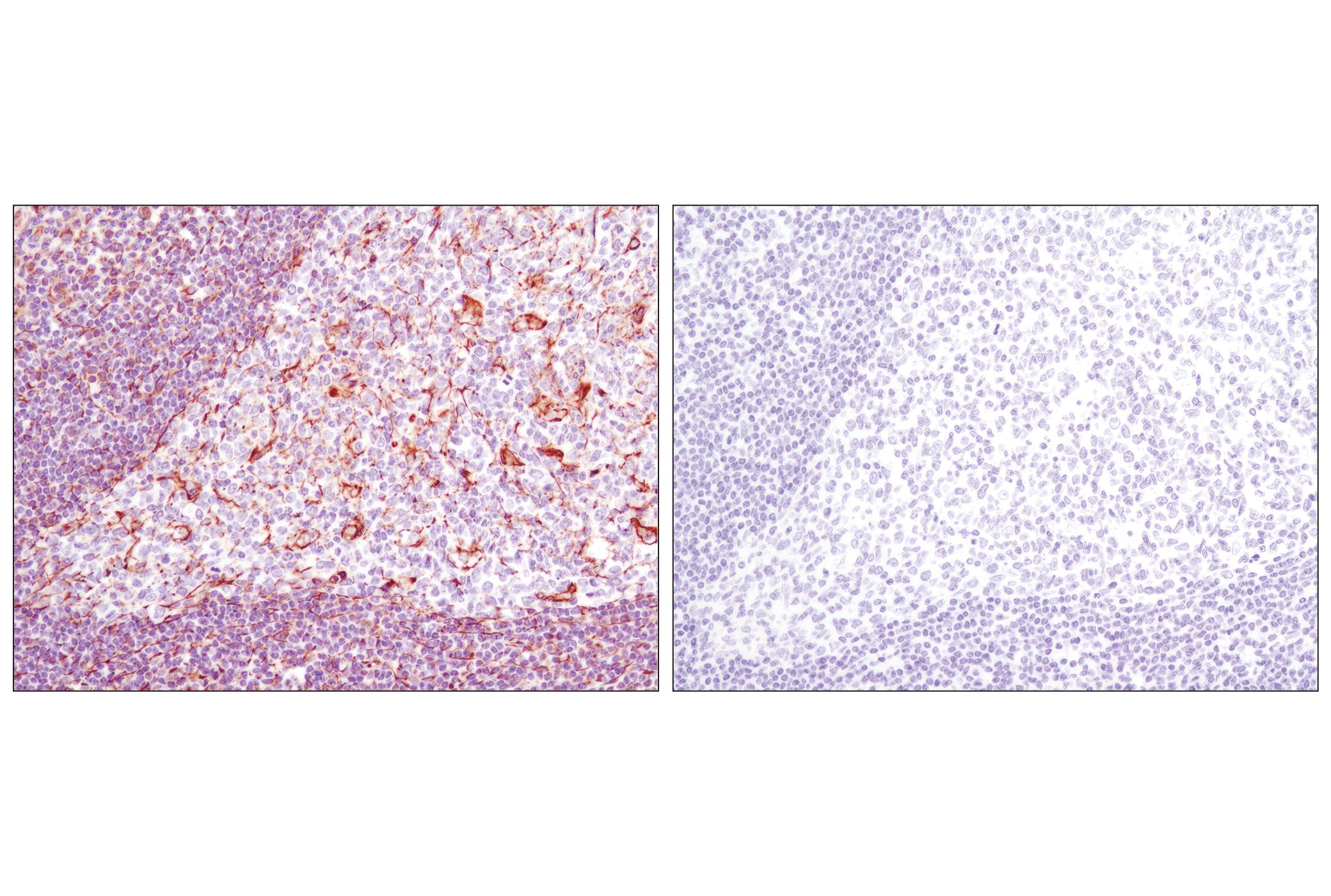  Image 46: Cell Fractionation Antibody Sampler Kit