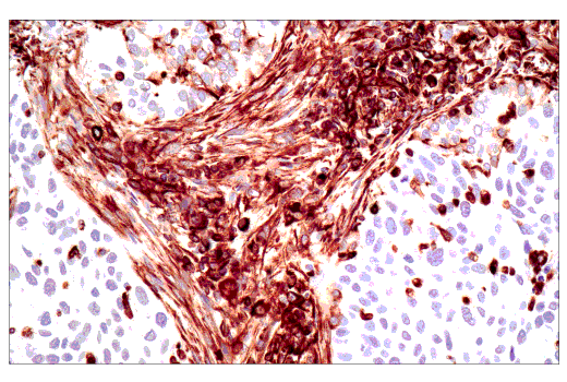  Image 21: Epithelial-Mesenchymal Transition (EMT) IF Antibody Sampler Kit