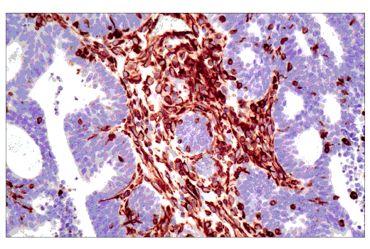  Image 26: Epithelial-Mesenchymal Transition (EMT) IF Antibody Sampler Kit