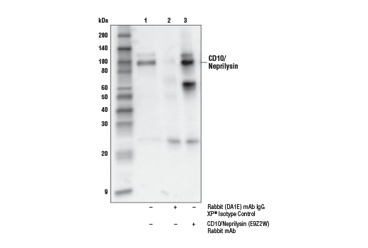 Immunoprecipitation Image 1: CD10/Neprilysin (E9Z2W) Rabbit mAb
