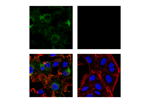 Immunofluorescence Image 1: CD10/Neprilysin (E9Z2W) Rabbit mAb