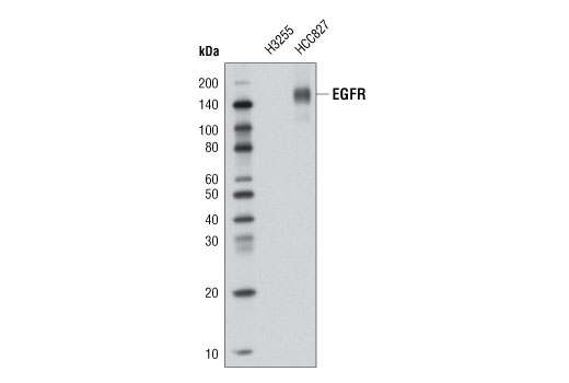 Western Blotting Image 1: EGF Receptor (E746-A750del Specific) (D6B6) XP® Rabbit mAb (Biotinylated)