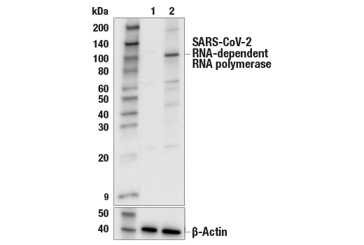 Western Blotting Image 1: SARS-CoV-2 RNA-dependent RNA Polymerase (E4X1Z) Rabbit mAb