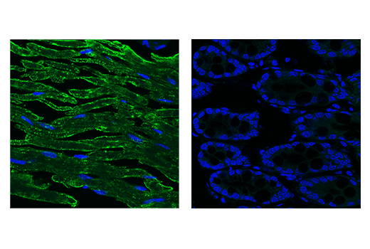 Immunofluorescence Image 1: Myelin Protein Zero Antibody
