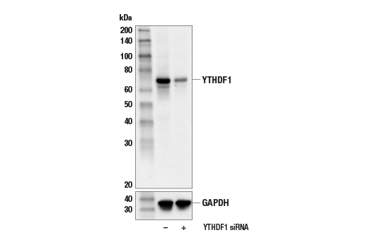  Image 6: N6-Methyladenosine (m6A) Binding Protein Antibody Sampler Kit