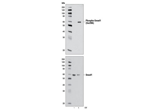  Image 4: Smad 1/5/9 Antibody Sampler Kit