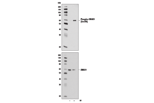  Image 6: SMAD 1/5/9 Antibody Sampler Kit