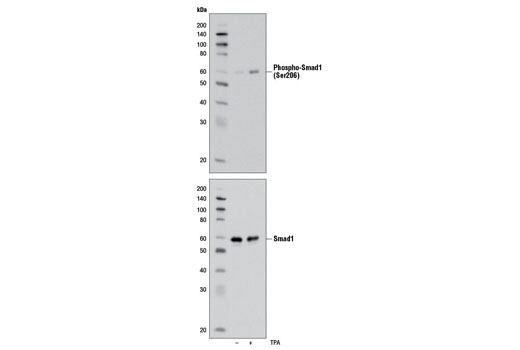  Image 11: Smad 1/5/9 Antibody Sampler Kit