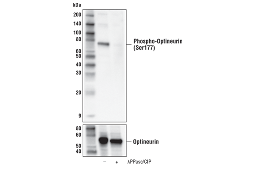 Western Blotting Image 2: Phospho-Optineurin (Ser177) Antibody