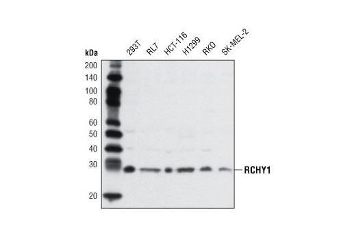 Western Blotting Image 1: RCHY1 Antibody