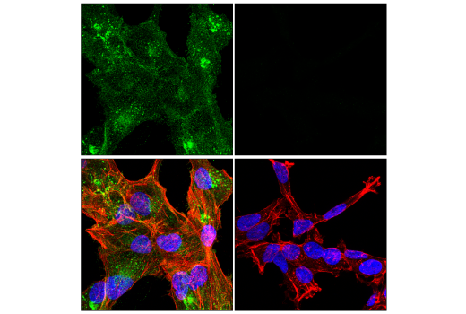 Immunofluorescence Image 1: LTβR (E5I6X) Rabbit mAb