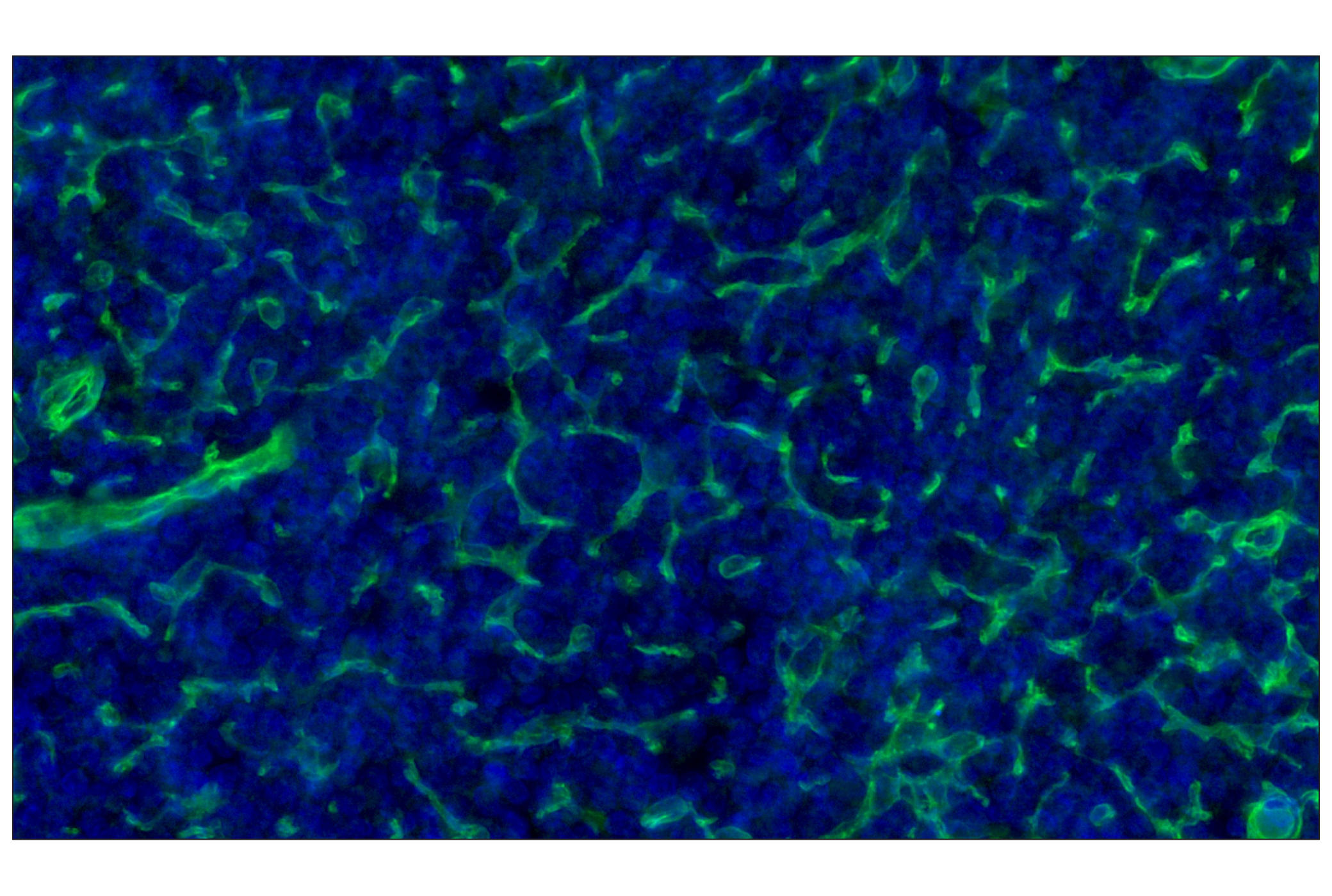 Immunohistochemistry Image 1: CD141/Thrombomodulin (E7Y9P) XP® Rabbit mAb (Alexa Fluor® 488 Conjugate)