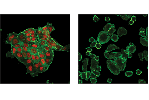 Immunofluorescence Image 1: Estrogen Receptor α (D6R2W) Rabbit mAb (Alexa Fluor® 647 Conjugate)
