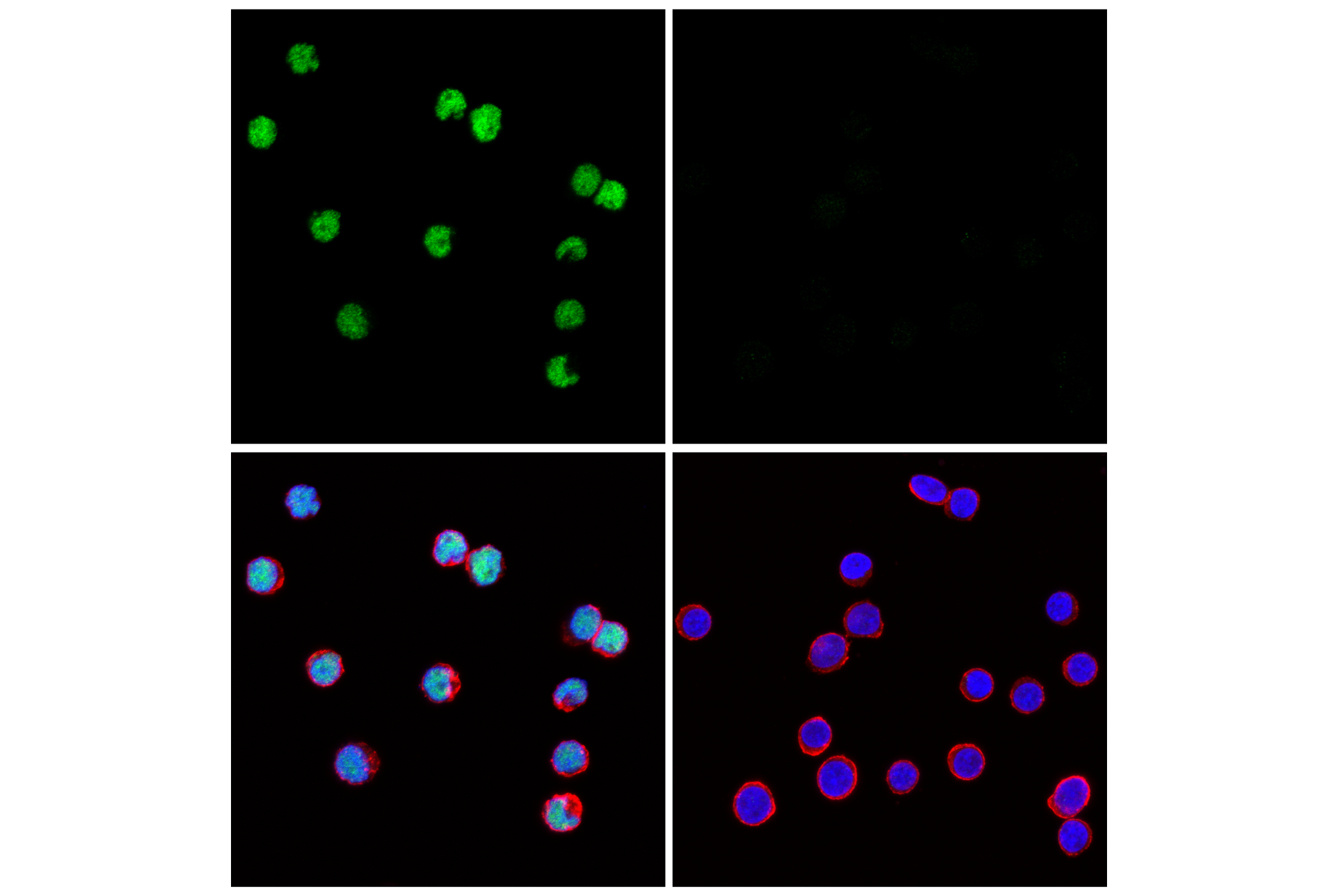 Immunofluorescence Image 1: EBF1 (E2I3Q) Rabbit mAb