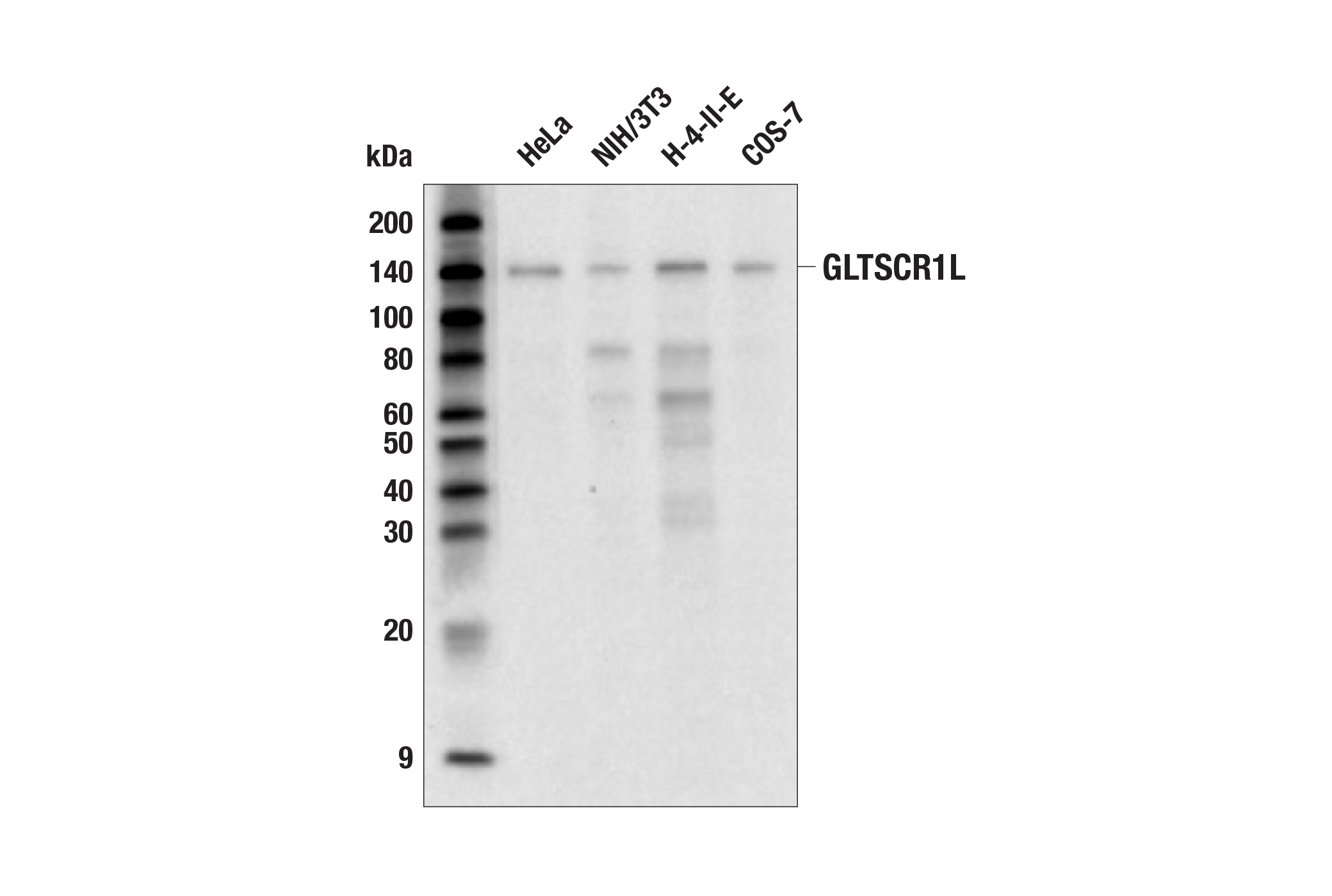 Western Blotting Image 1: GLTSCR1L (E4D9W) Mouse mAb