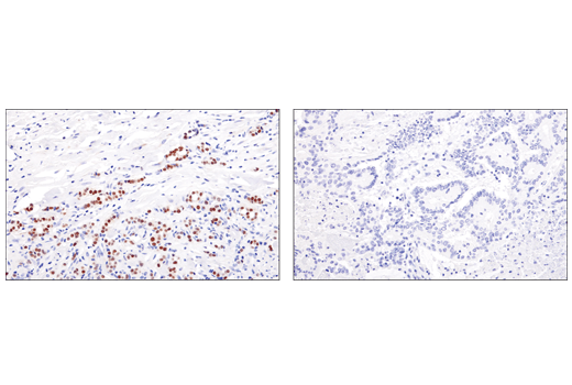 Immunohistochemistry Image 1: GATA-3 (E2N1Y) Mouse mAb (BSA and Azide Free)