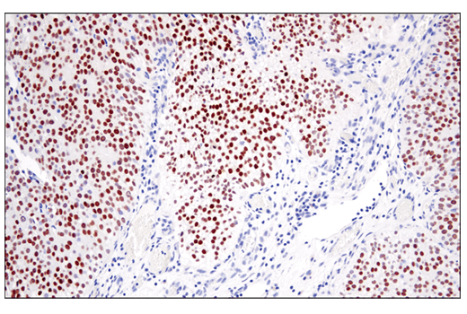 Immunohistochemistry Image 3: GATA-3 (E2N1Y) Mouse mAb (BSA and Azide Free)