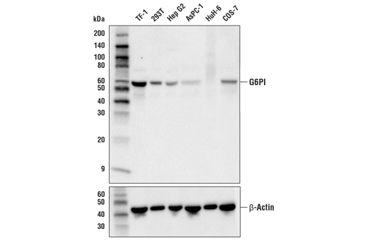 Western Blotting Image 1: GPI Antibody