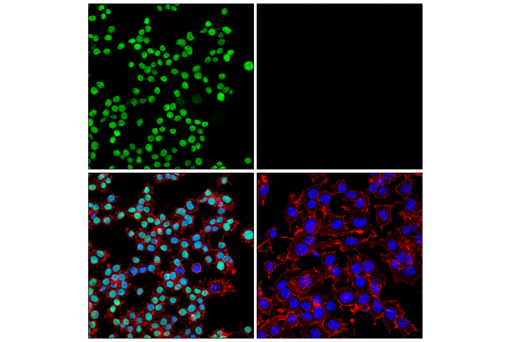 Immunofluorescence Image 2: PU.1 (F2D5A) Mouse mAb