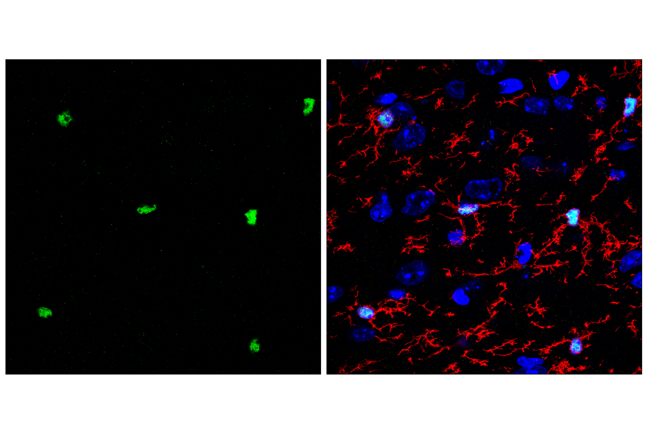 Immunofluorescence Image 1: PU.1 (F2D5A) Mouse mAb