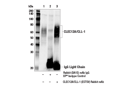 Immunoprecipitation Image 1: CLEC12A/CLL-1 (E5T5V) Rabbit mAb